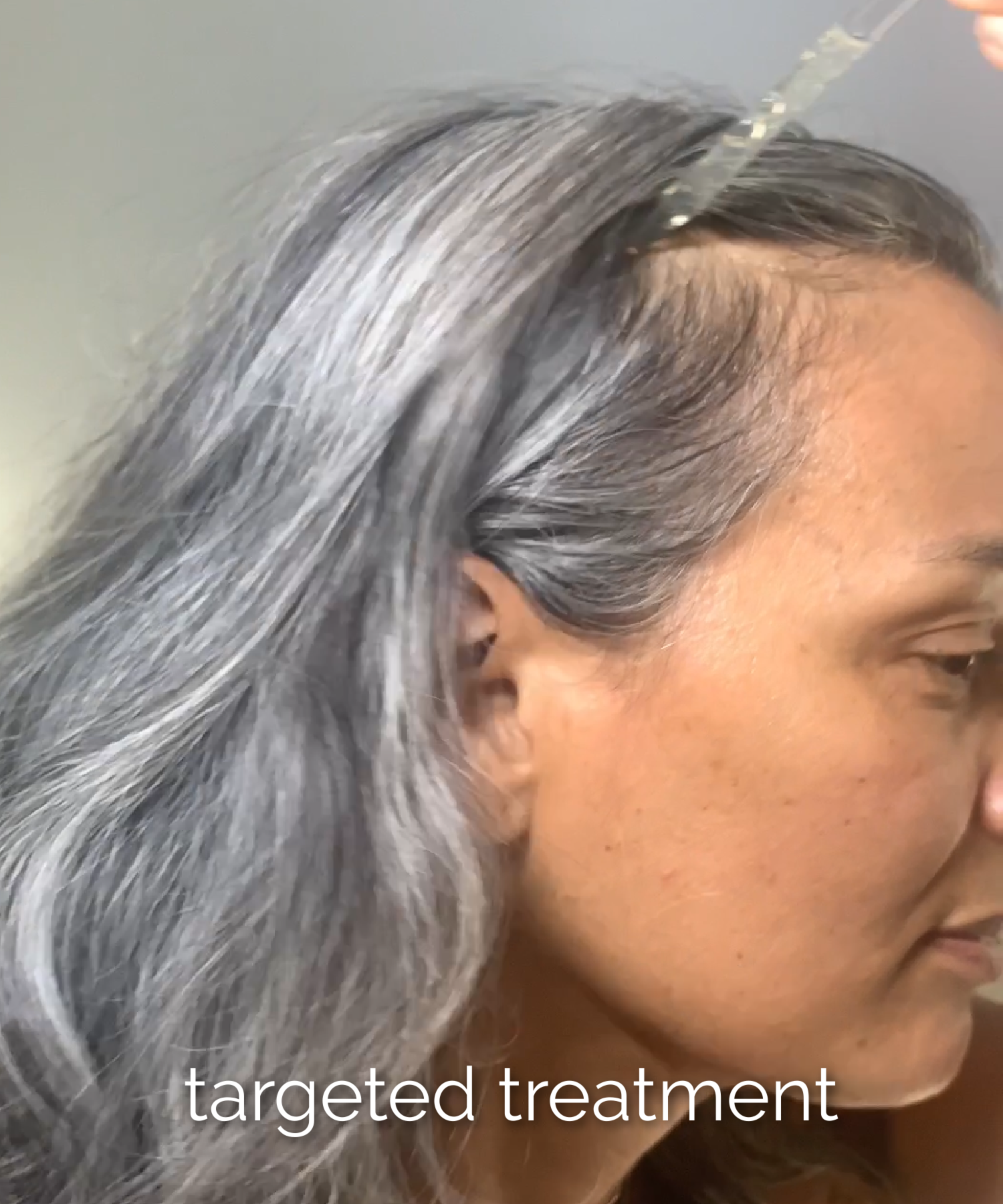 Treatment for Hair Loss | Replenishing Hair Serum with Redensyl® - Image 2